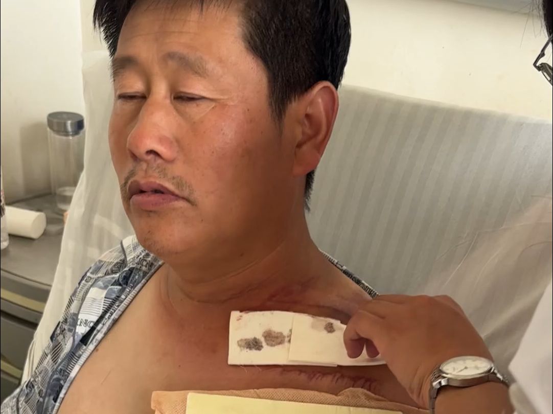 养牛户赊账10万元，我爸竟还继续给他家看病，背后原因令人暖心