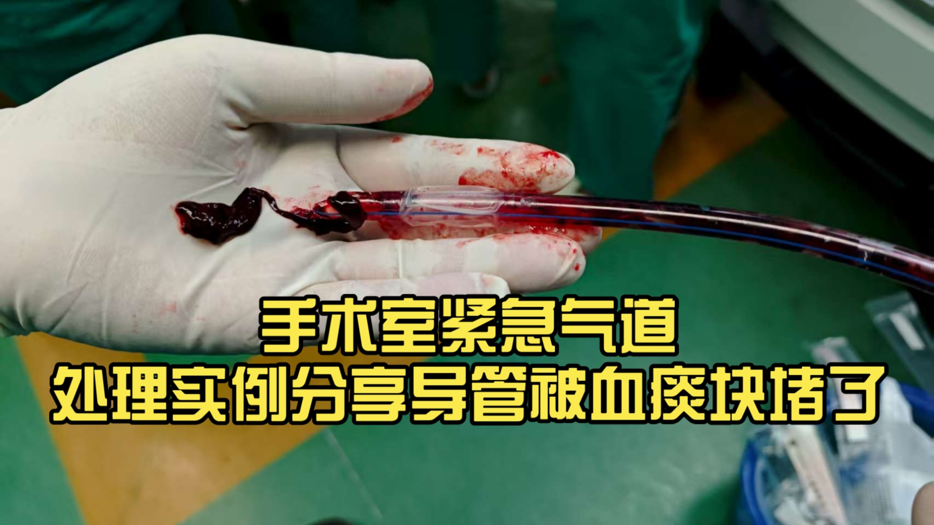 手术室紧急气道处理实例分享导管被血痰块堵了 临床判断和处