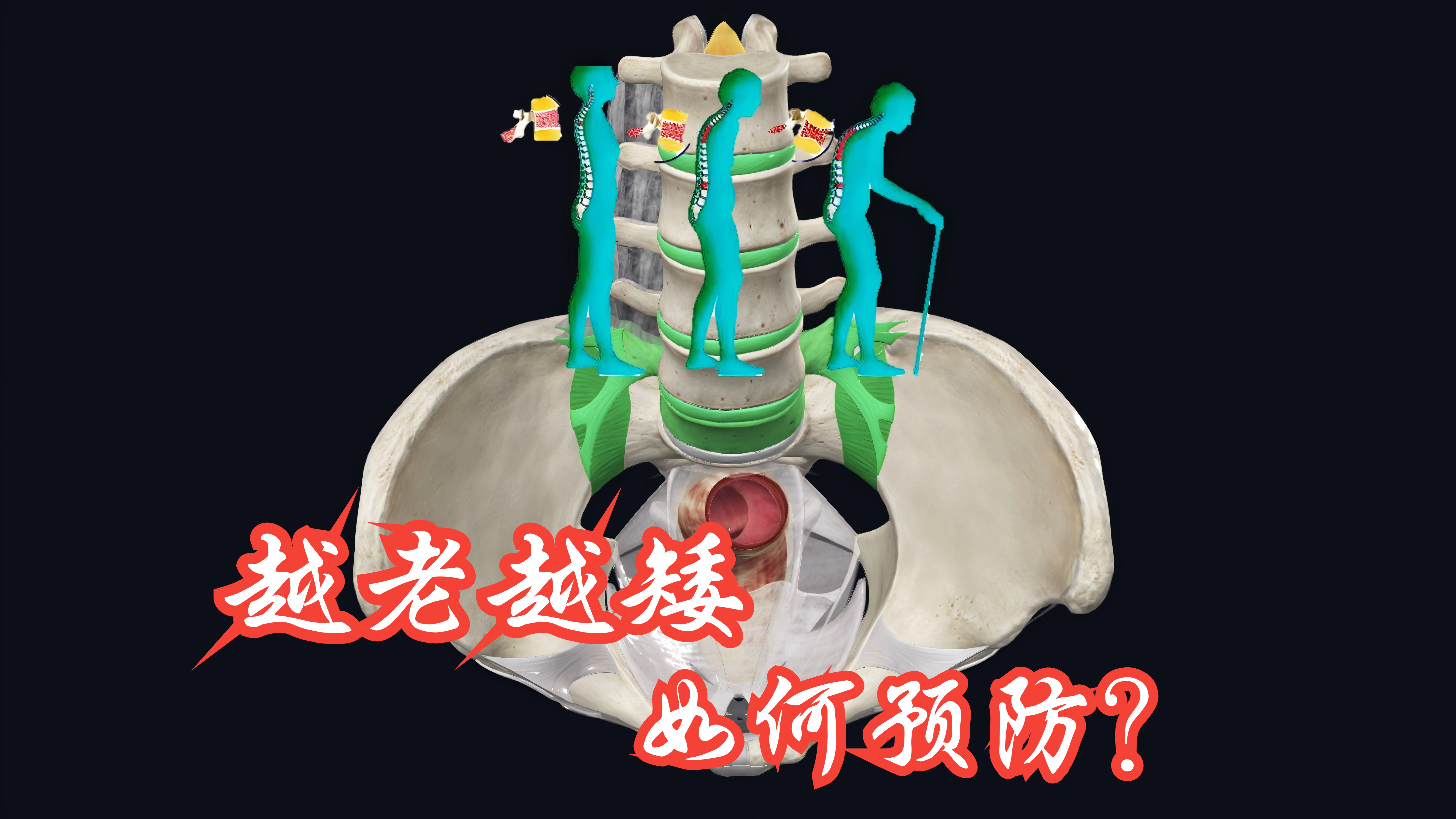 越老越矮，是为什么呢，如何预防？