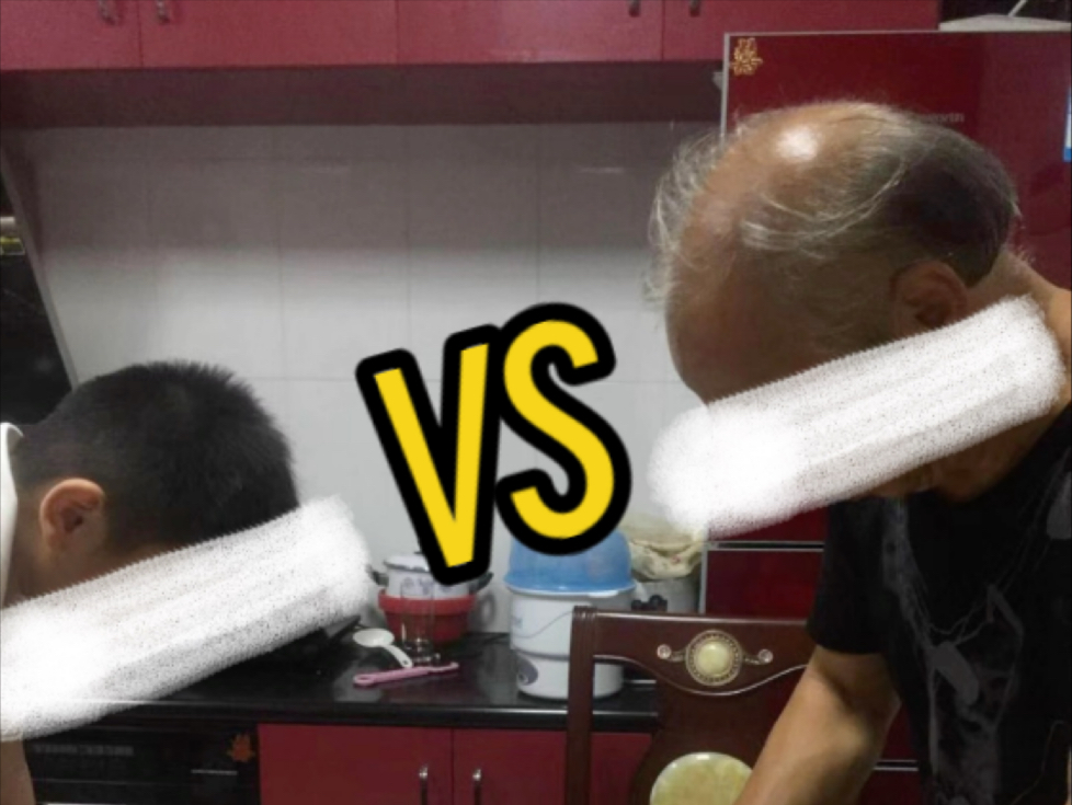脱发治疗快8年了，对比一下老一辈，你觉的有效果吗？
