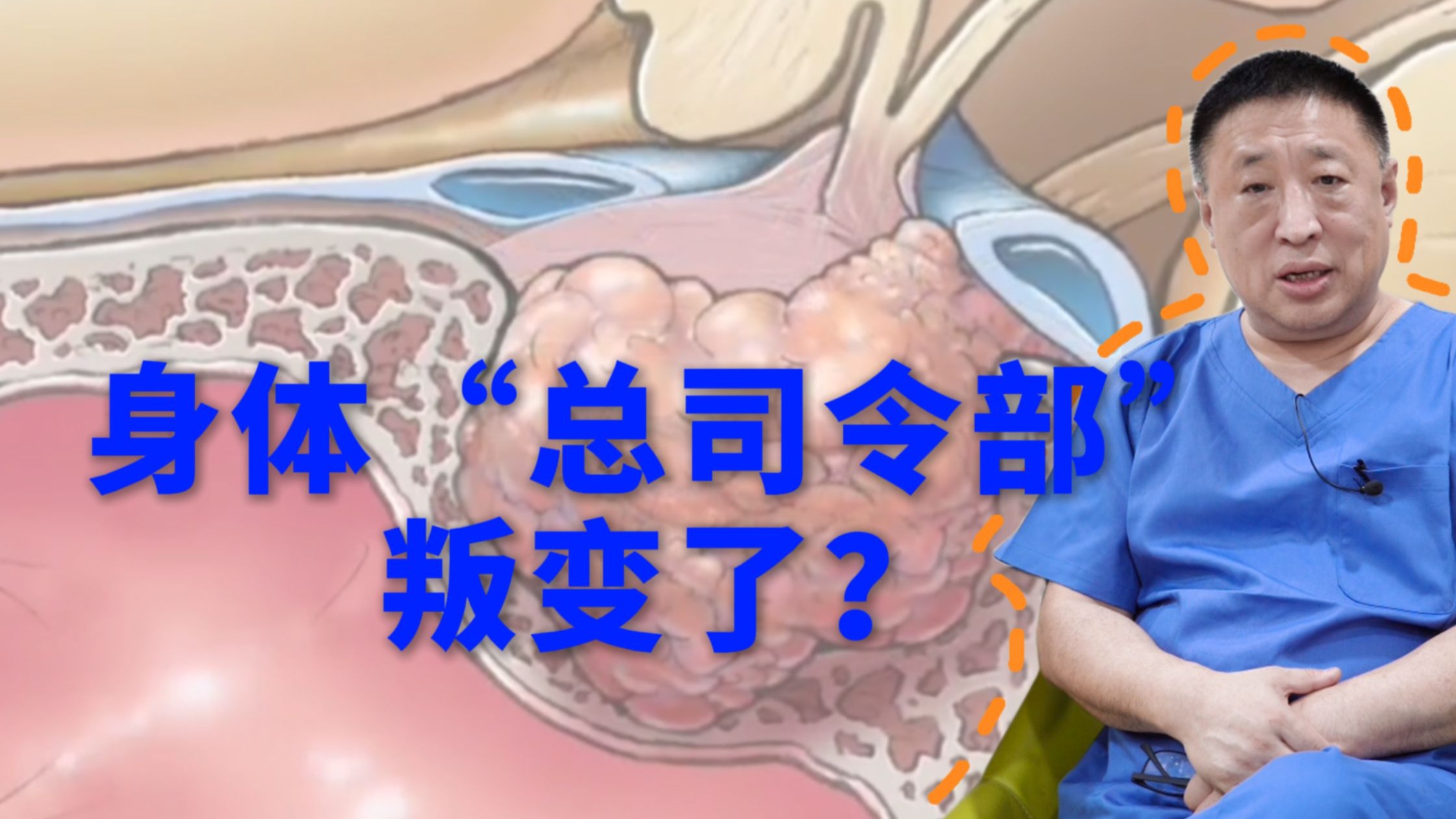 视力下降、面容改变、莫名发胖？可能是大脑里的“开关”坏了