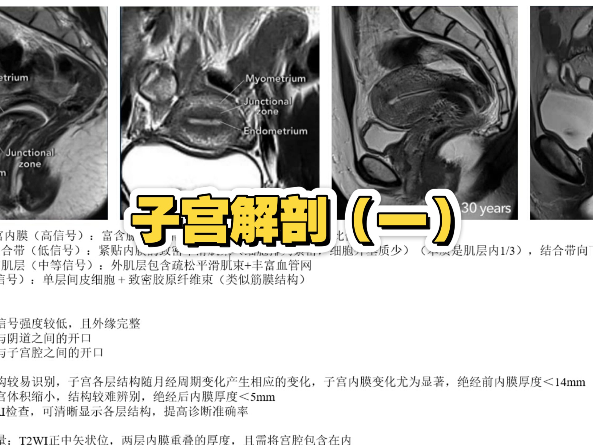 子宫解剖（一），小伙伴们速来学习吧~