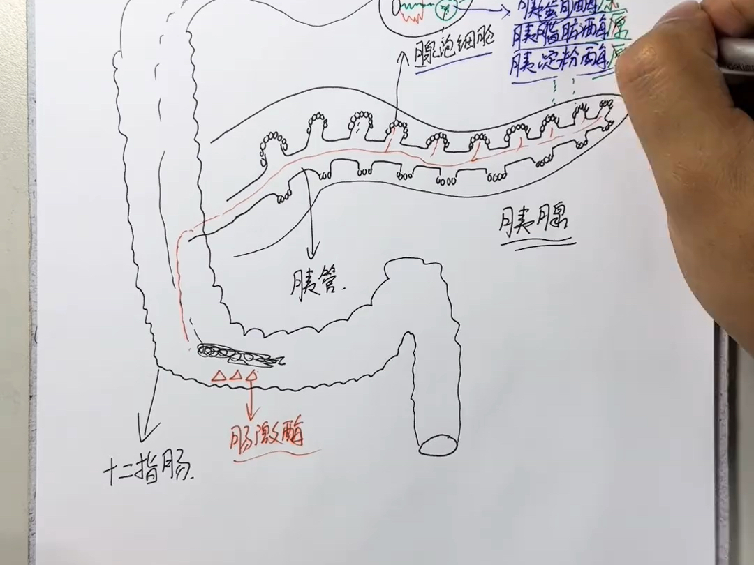 急性胰腺炎
