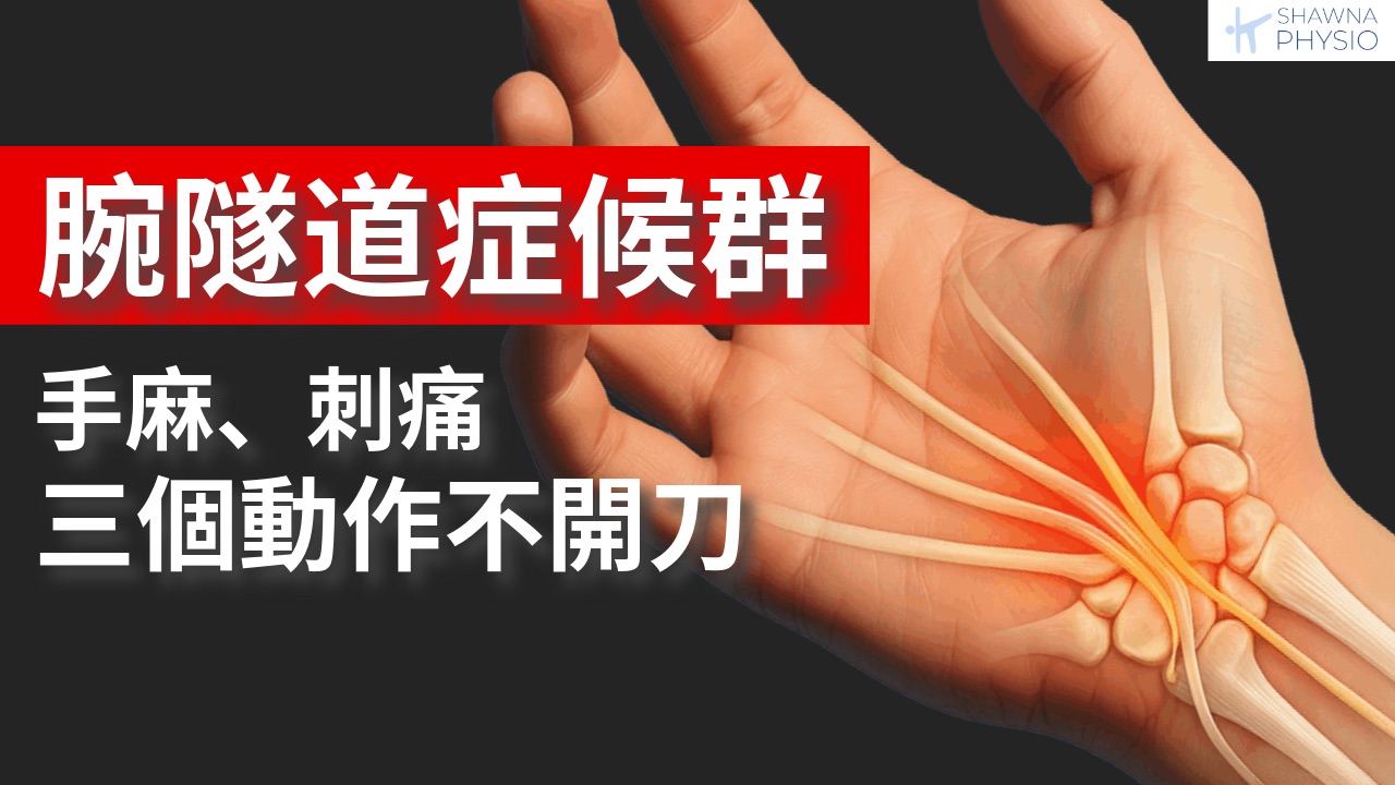 手麻、刺痛、睡到一半痛醒？你可能有【腕隧道症候群】完整解说