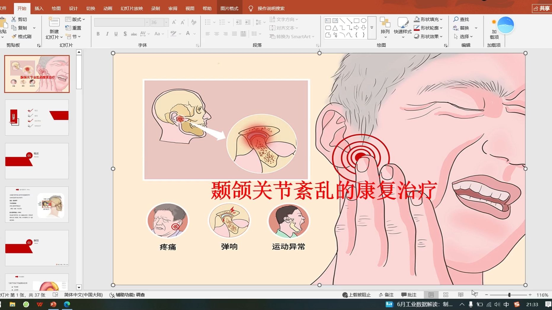 颞颌关节紊乱的康复治疗