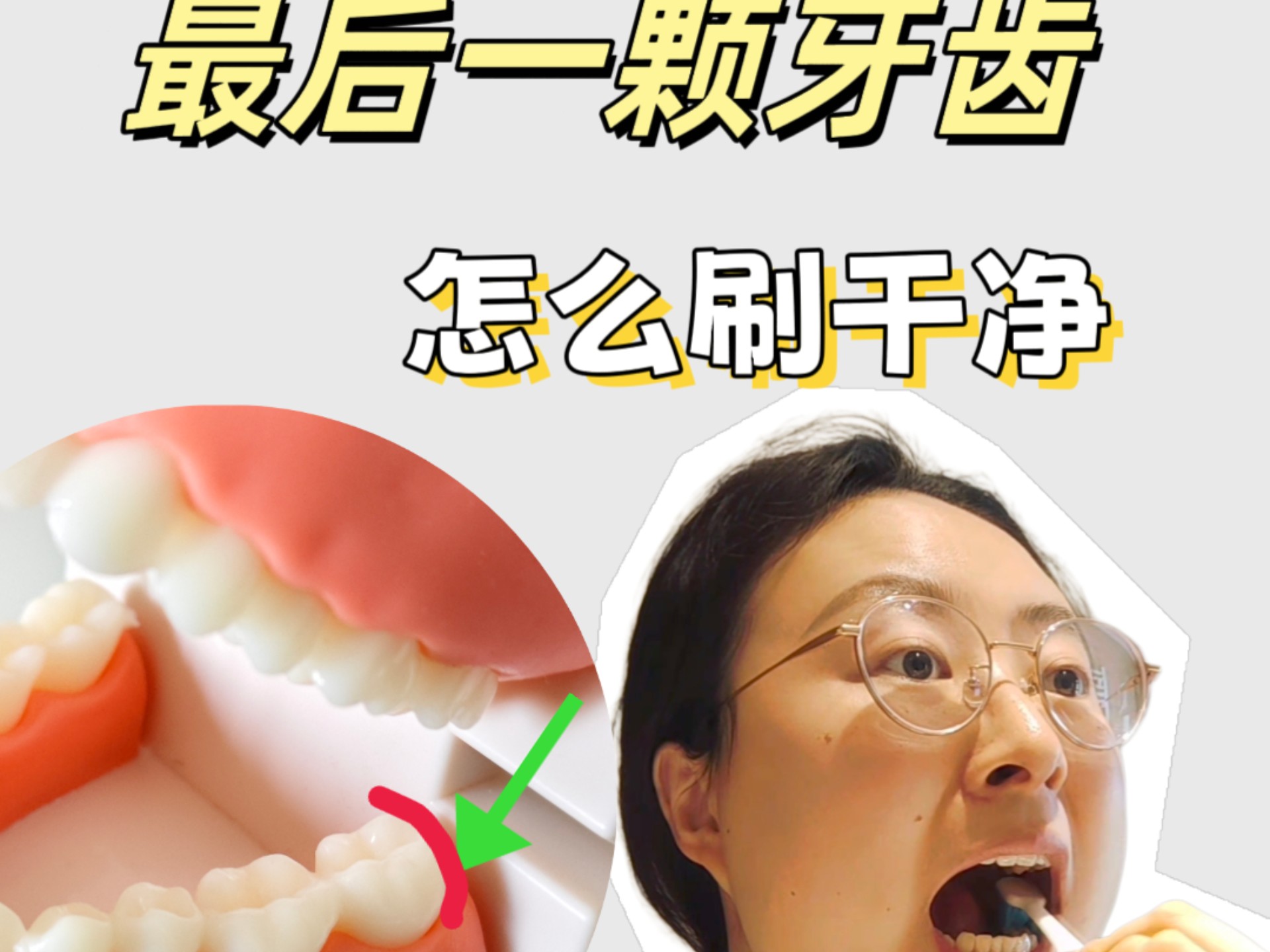 牙医教你|清洁盲区:最后一颗牙齿末端怎么刷