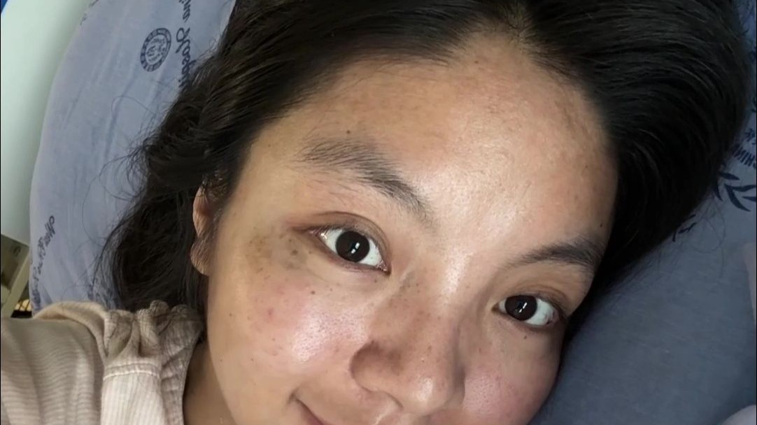 治疗了10个月，准备听大家的去北京看看啦，祝我好运~