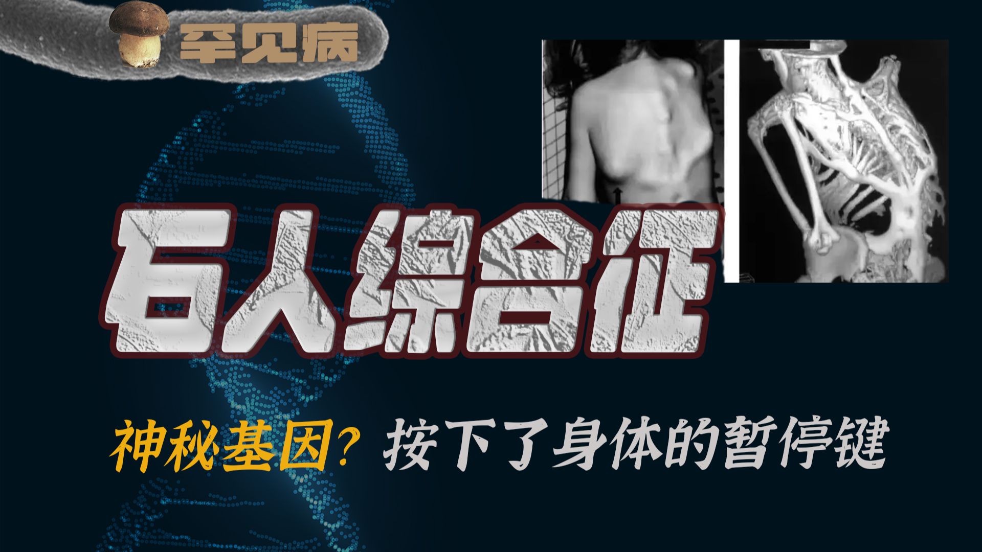 疯 狂 的 骨 头