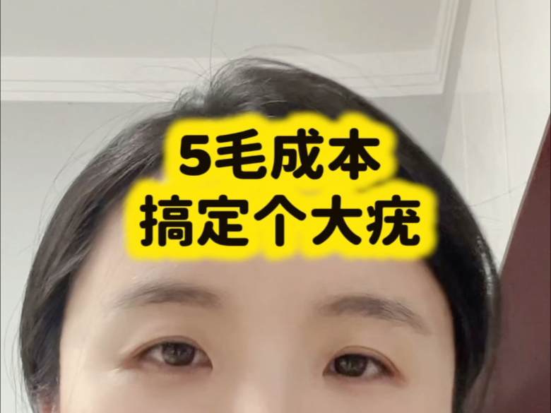 我花了5毛去疣经历