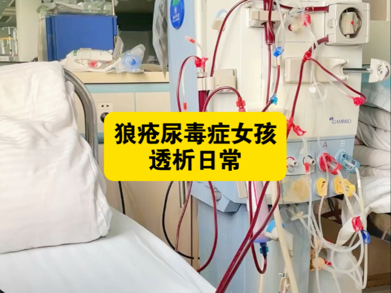 五点开始透析，我五点十五才到也不会着急了，以前谁先到谁上机，现