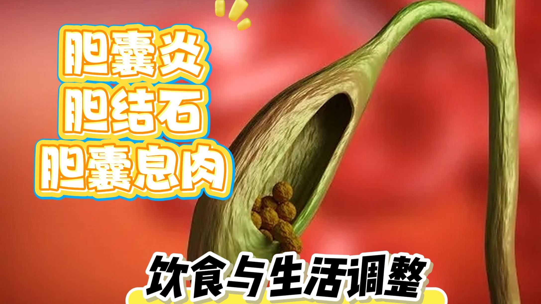 胆囊炎胆结石和胆囊息肉的饮食与生活调整