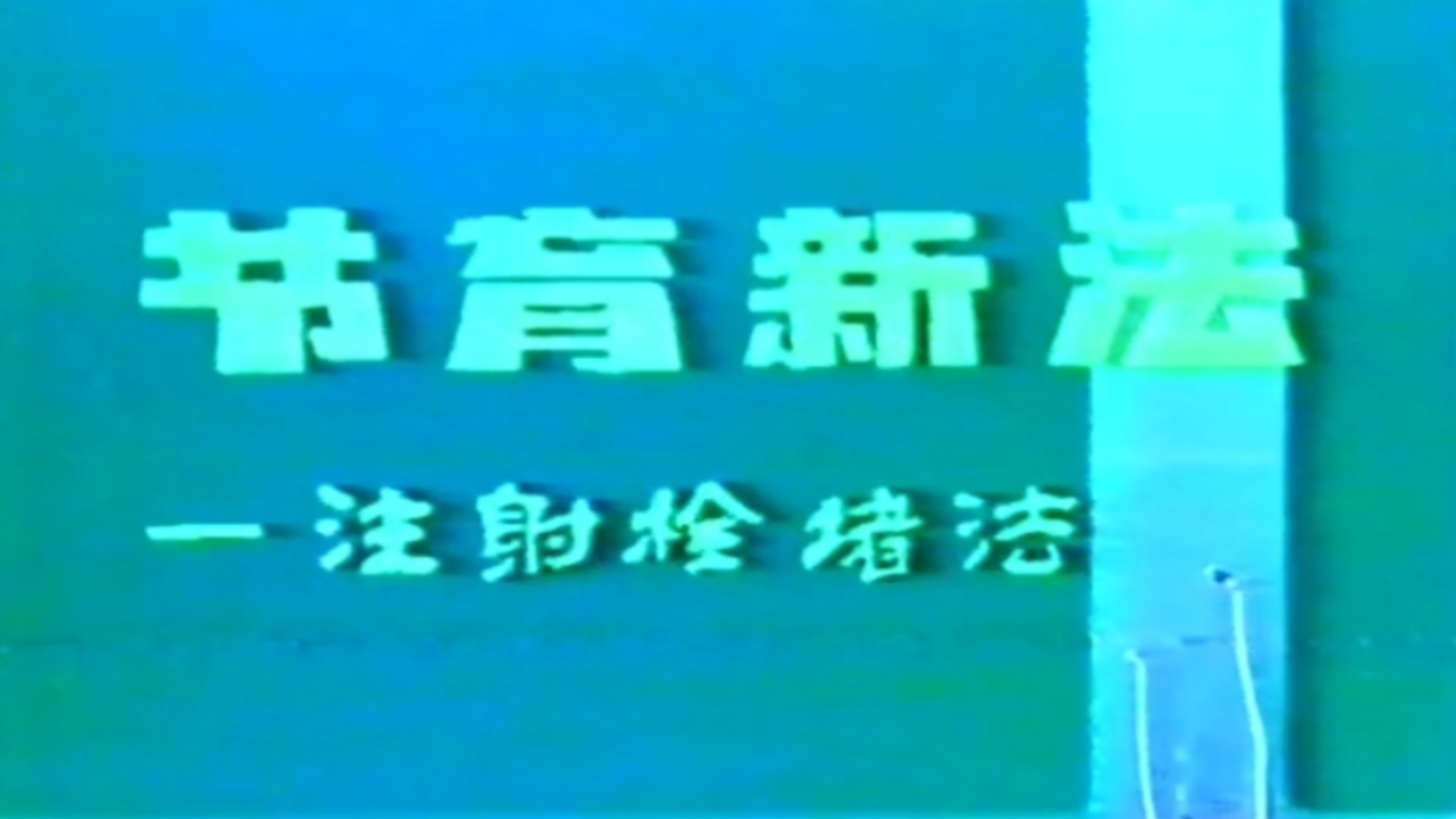 怀旧科教片《节育新法-注射栓堵法》