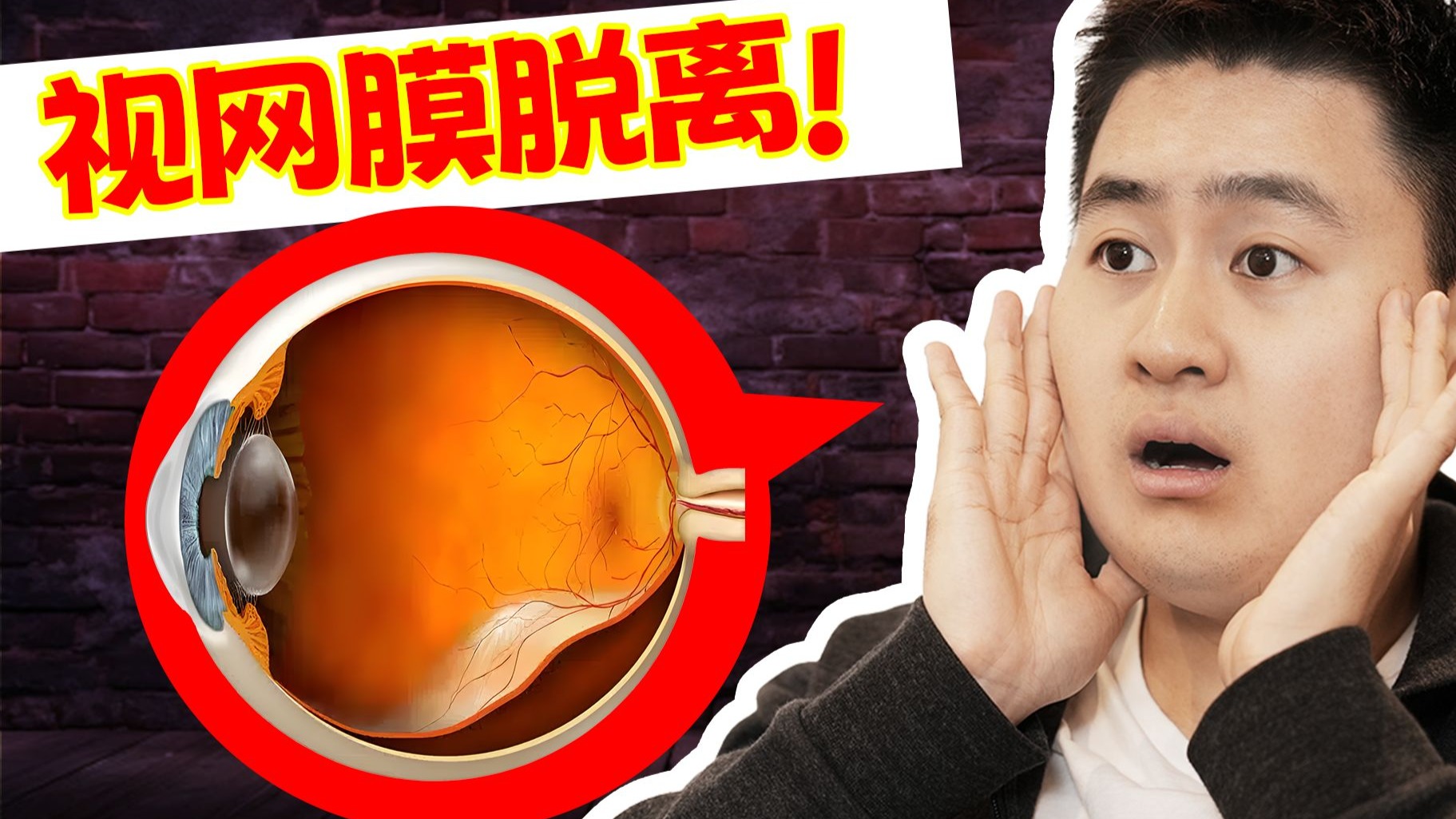 眼底病 - 什么是视网膜脱离？网脱一定会失明吗？