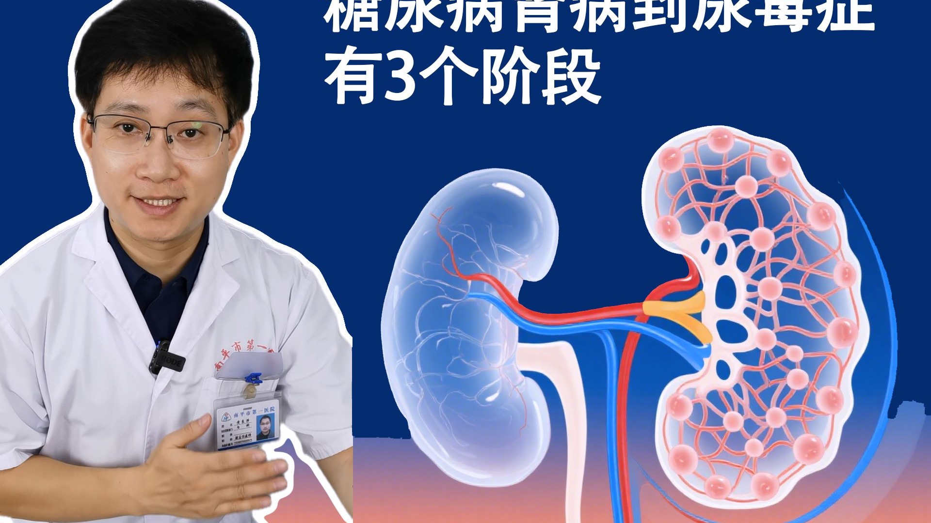 糖尿病肾病：尿蛋白到尿毒症，有3个阶段