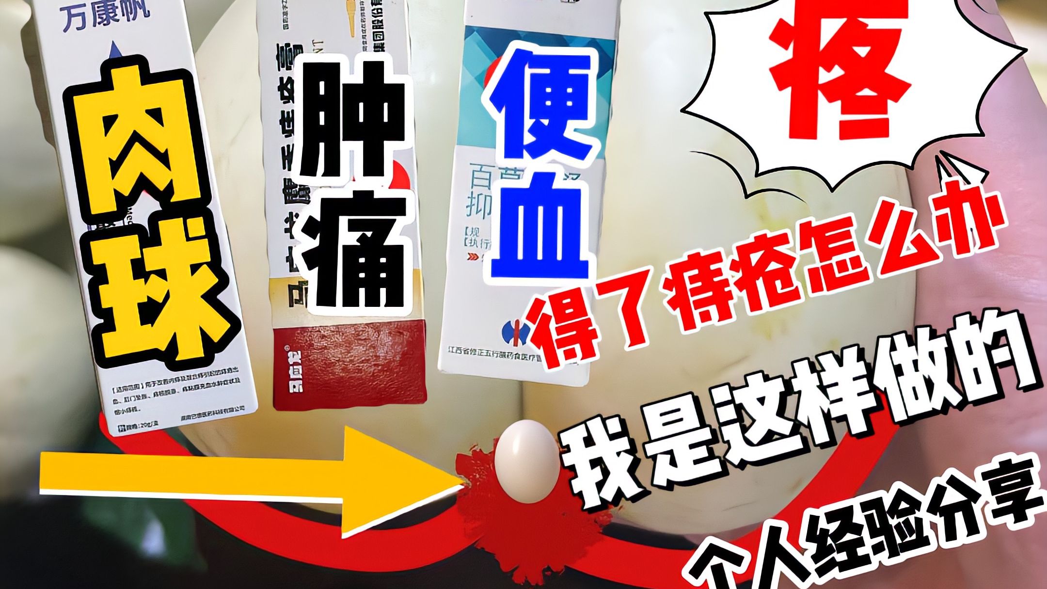 关于痔疮肉球如何用药的方法分享！