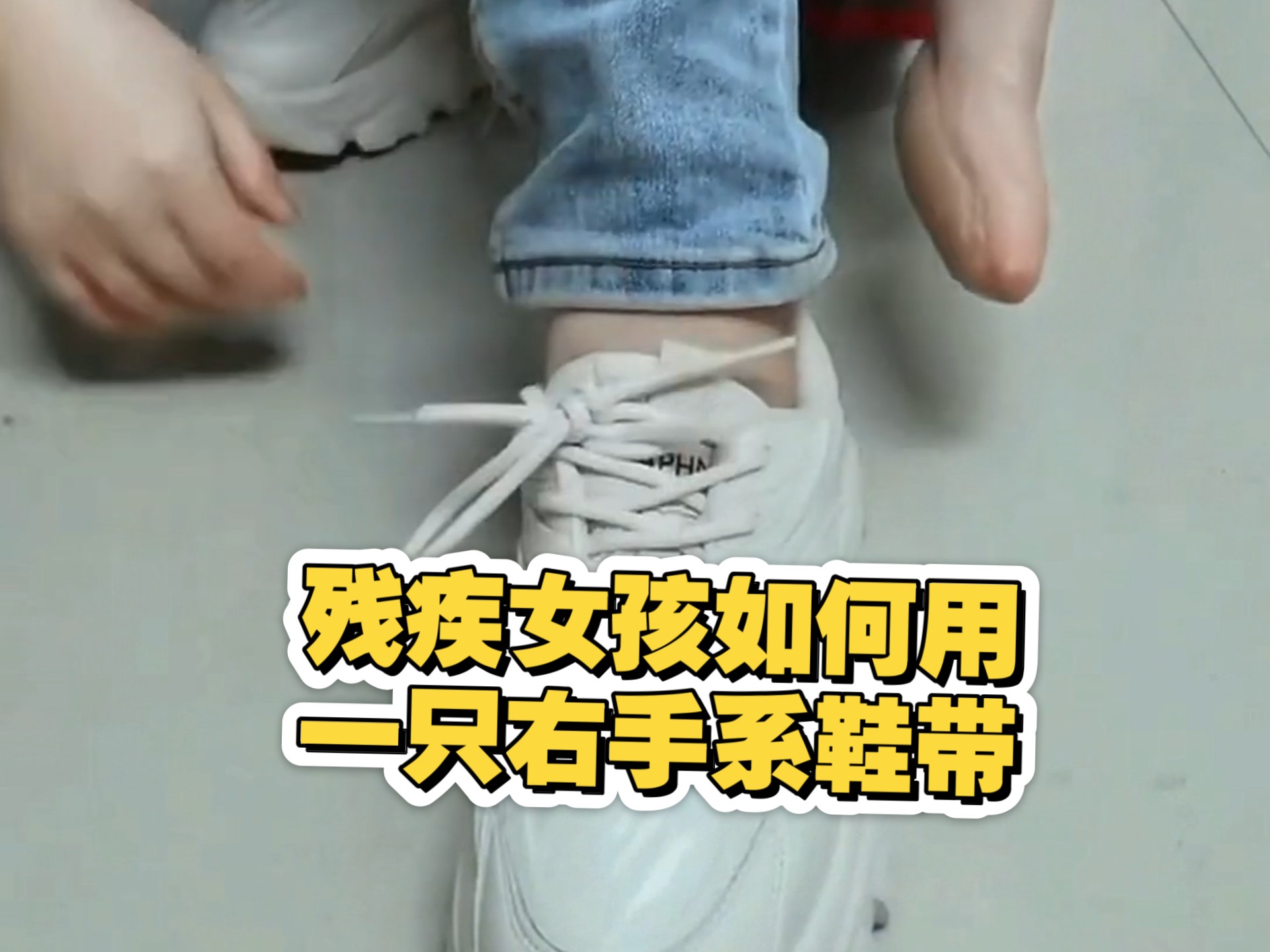 请给我一点时间，看我如何用我的右手和左手截肢后仅存的前臂来
