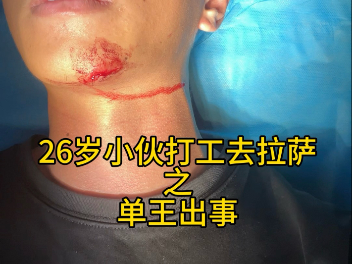 【武汉历险记】第一集：单王出事！送外卖太危险了，还没开始就结束
