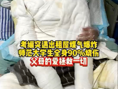 我比谁都怕痛，却比谁都勇敢。