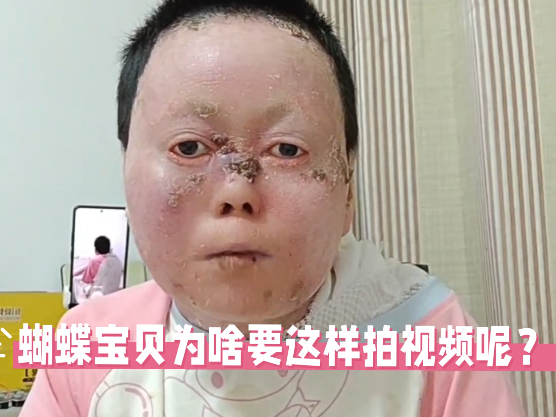 蝴蝶宝贝为啥要这样拍视频呢？