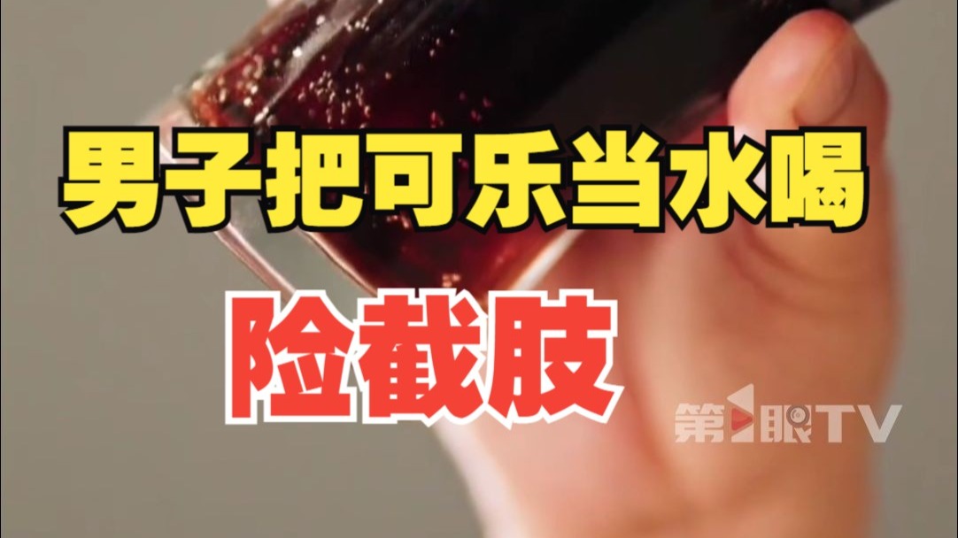 31岁男子把可乐当水喝，险截肢！