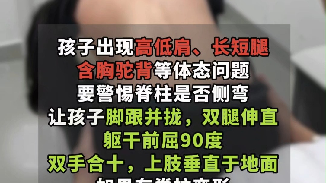孩子体态不好要引起重视，一个动作在家就能自测脊柱是否侧弯。