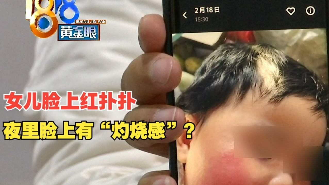 【1818黄金眼】夜里脸上“灼烧感” 天花板向下辐射？