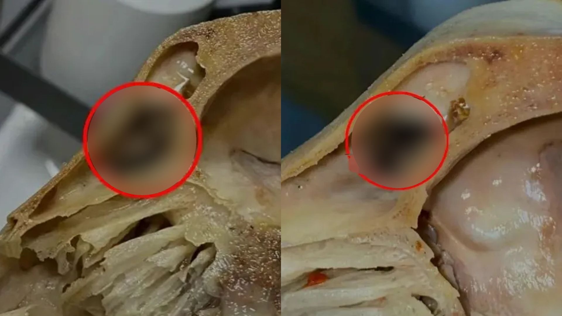 吃完发现全是蛆，恶心呕吐一整夜！商家傻眼“食用两天后才说”，上