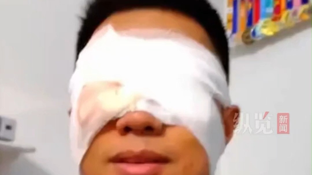 男子山上跑步速度较快且路途颠簸致视网膜脱离。
