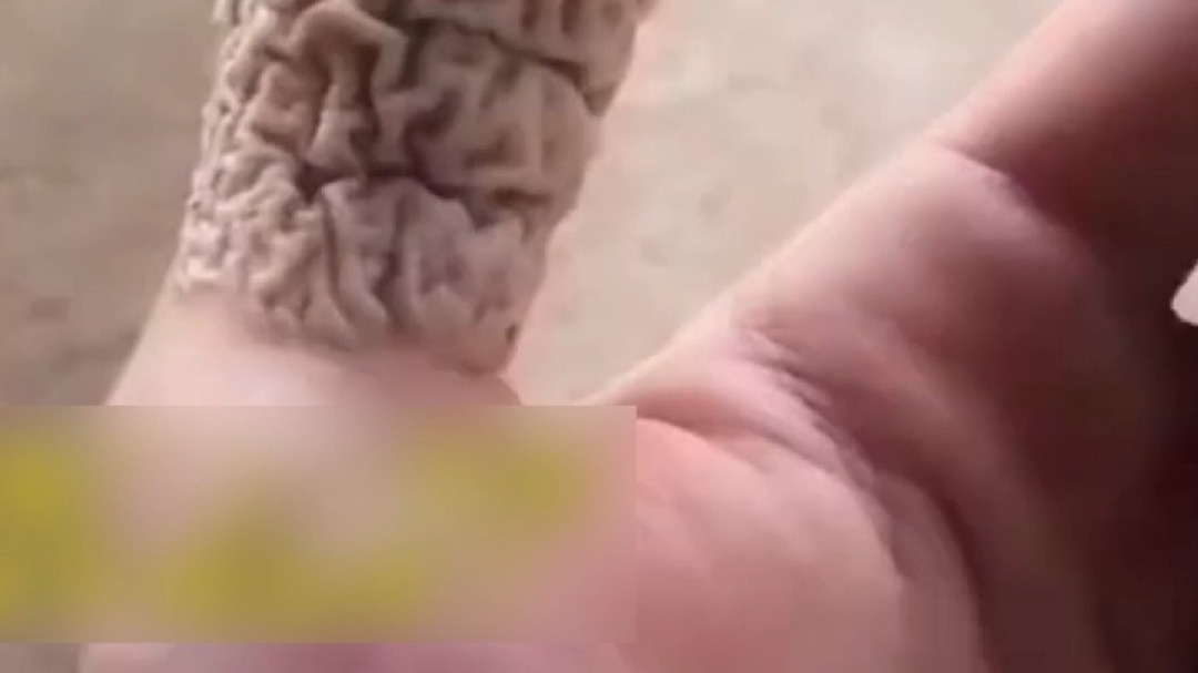 男子鞋厂上一天班  出来手竟然变成这样  网友：好恐怖……