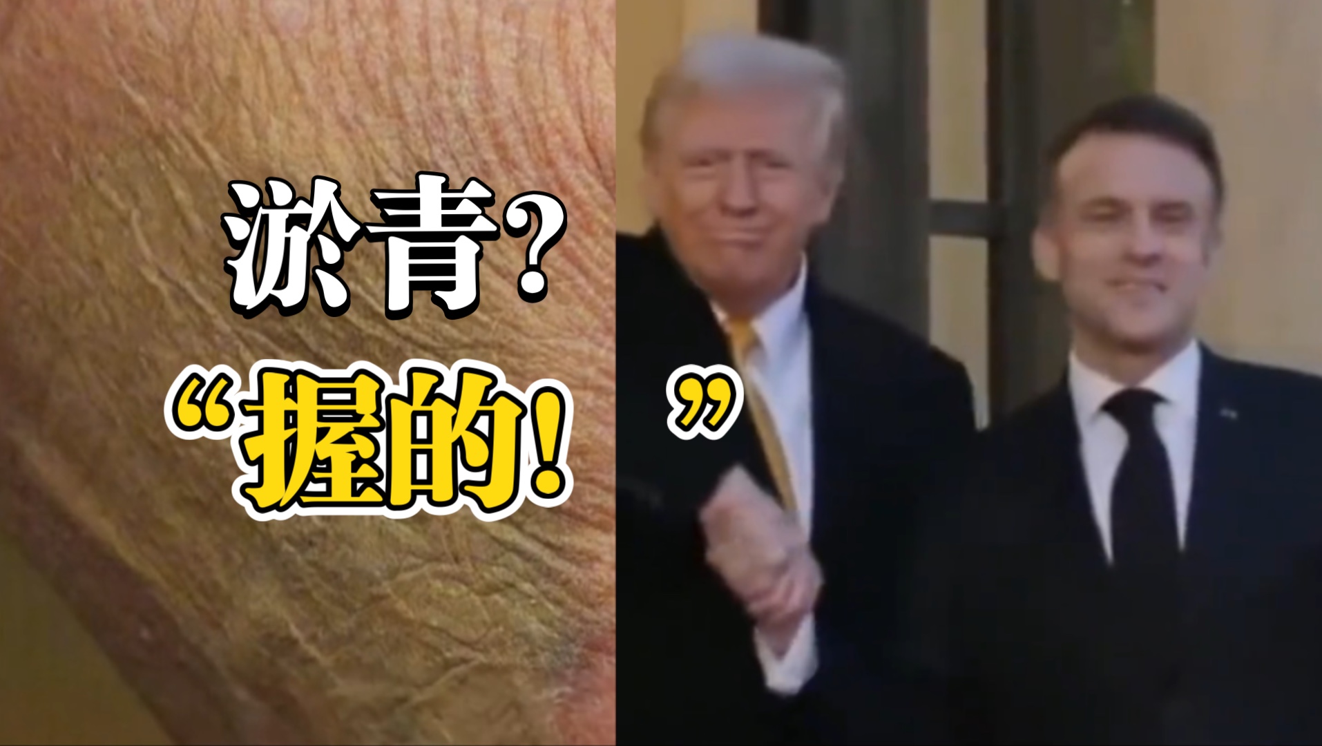 特朗普手背出现大块淤青？白宫回应：他握手握太多。