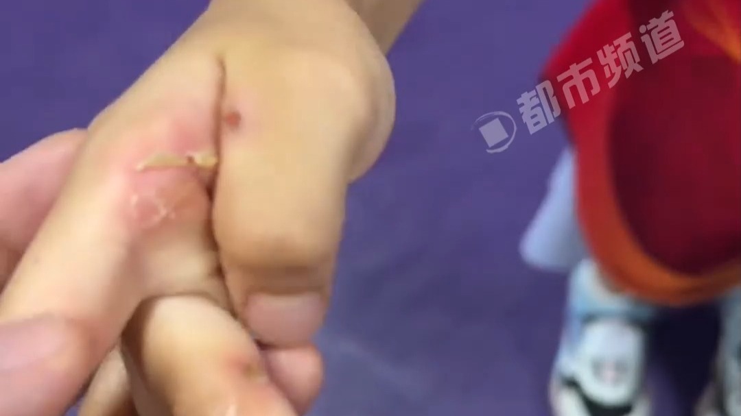 天真的眼神与布满茧子的手 网友：所有努力都会结果的 加油！