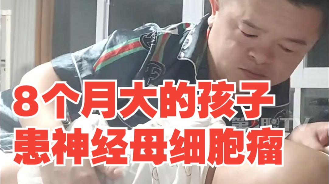 8个月大的孩子患神经母细胞瘤