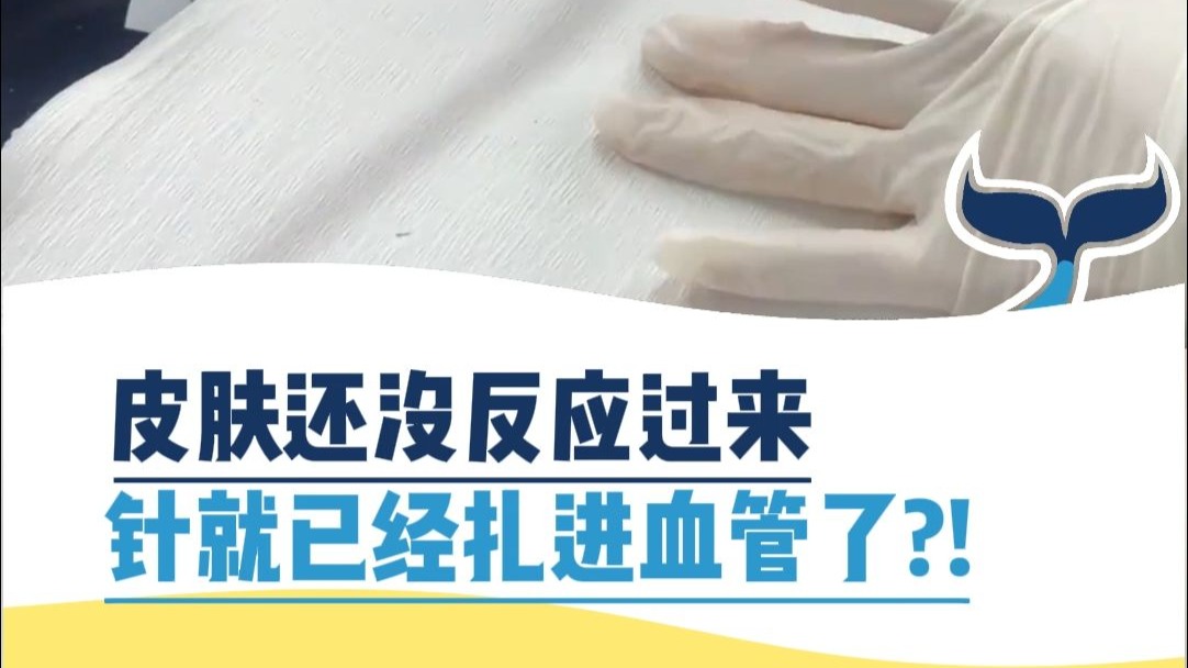 皮肤还没反应过来，针就已经扎进血管了