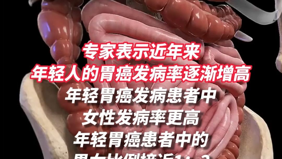 专家称年轻人胃癌发病率增长近80%。