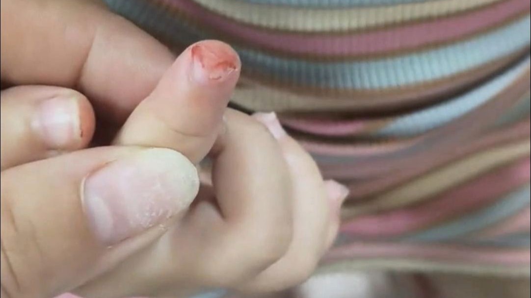 不是，她都不觉得痛吗？