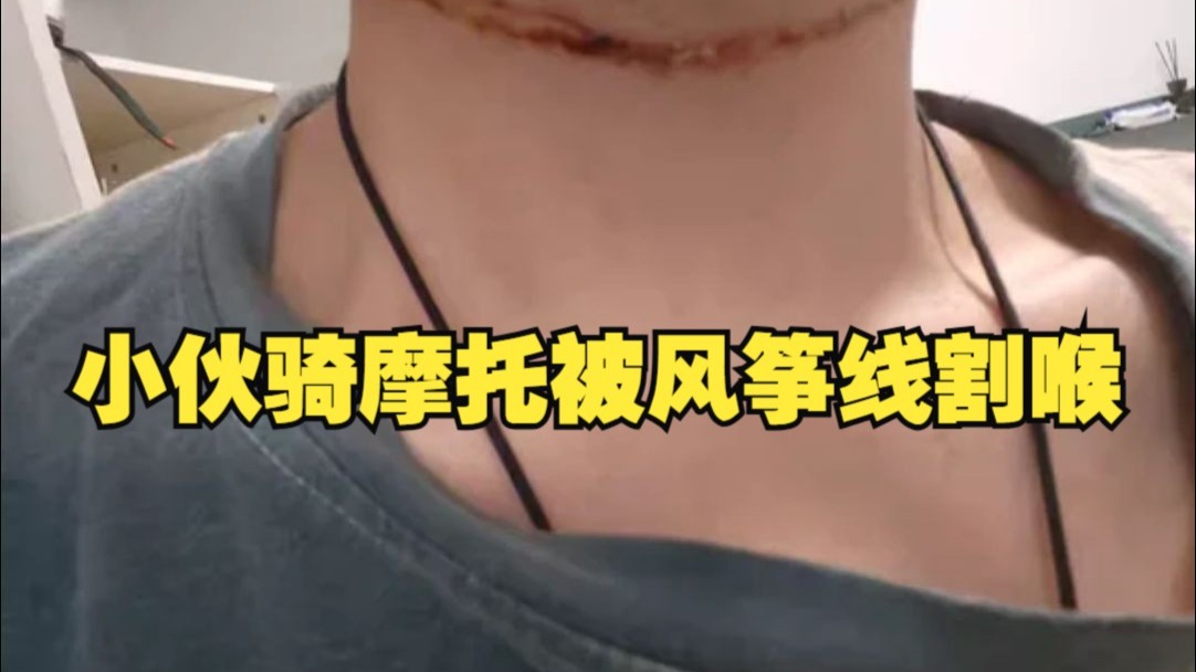 小伙骑摩托被风筝线割喉！