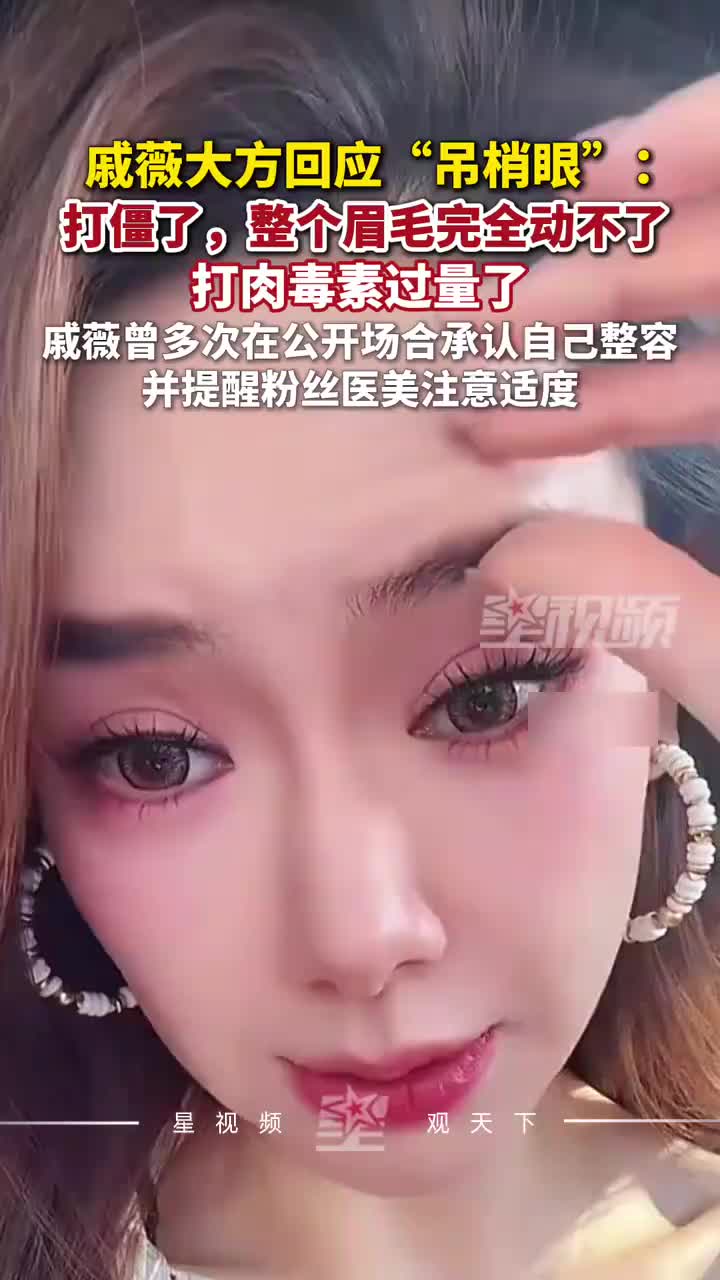 戚薇大大方方在直播中回应“吊梢眼”，是因为打肉毒素过量