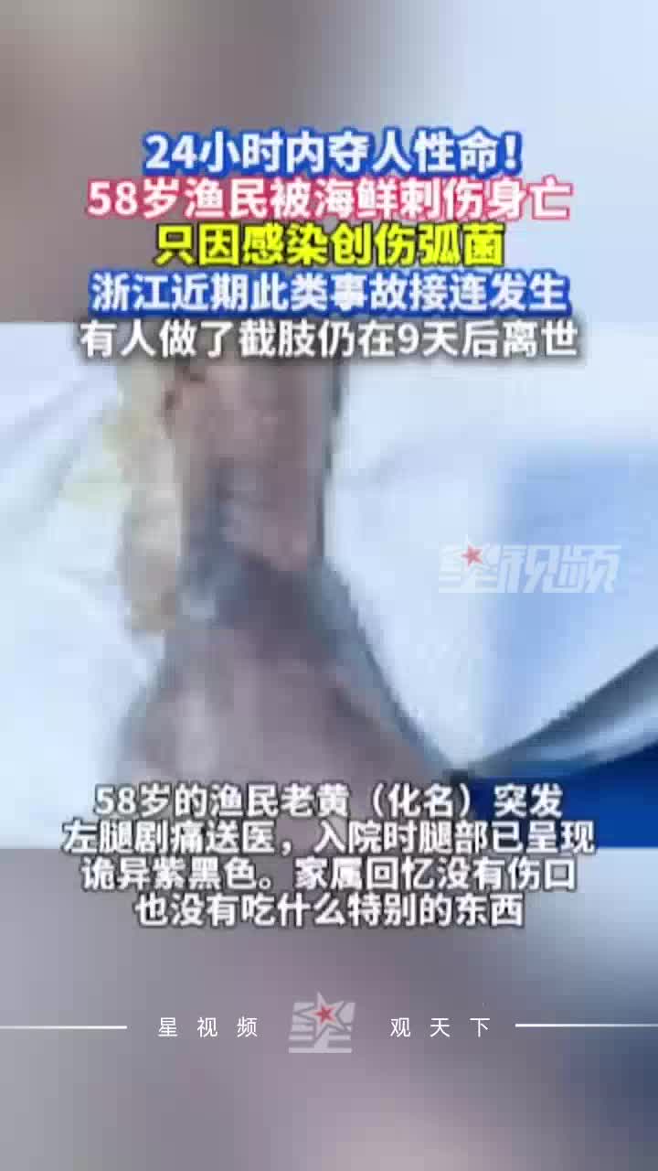 只因感染创伤弧菌，58岁渔民被海鲜刺伤身亡，有人截肢后仍离世