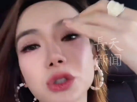40岁戚薇自曝注射肉毒过量导致眉毛完全动不了成了“吊梢眼”