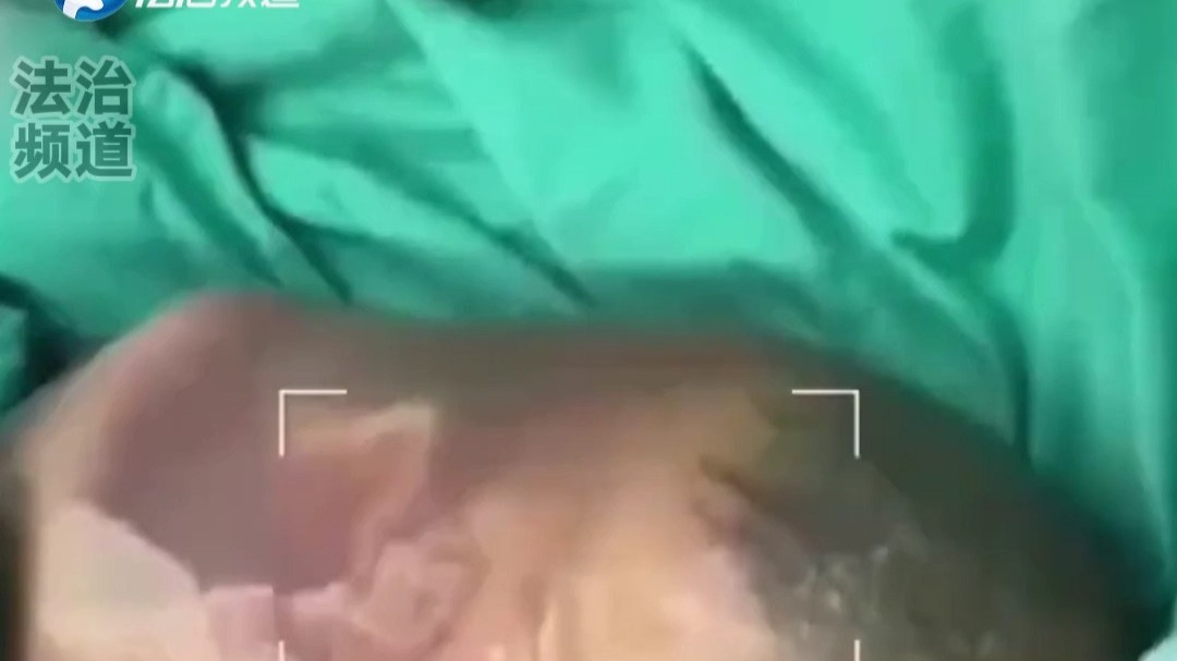 刚出生的婴儿被羊膜完整包围医护人员前来围观网友：好神奇呀
