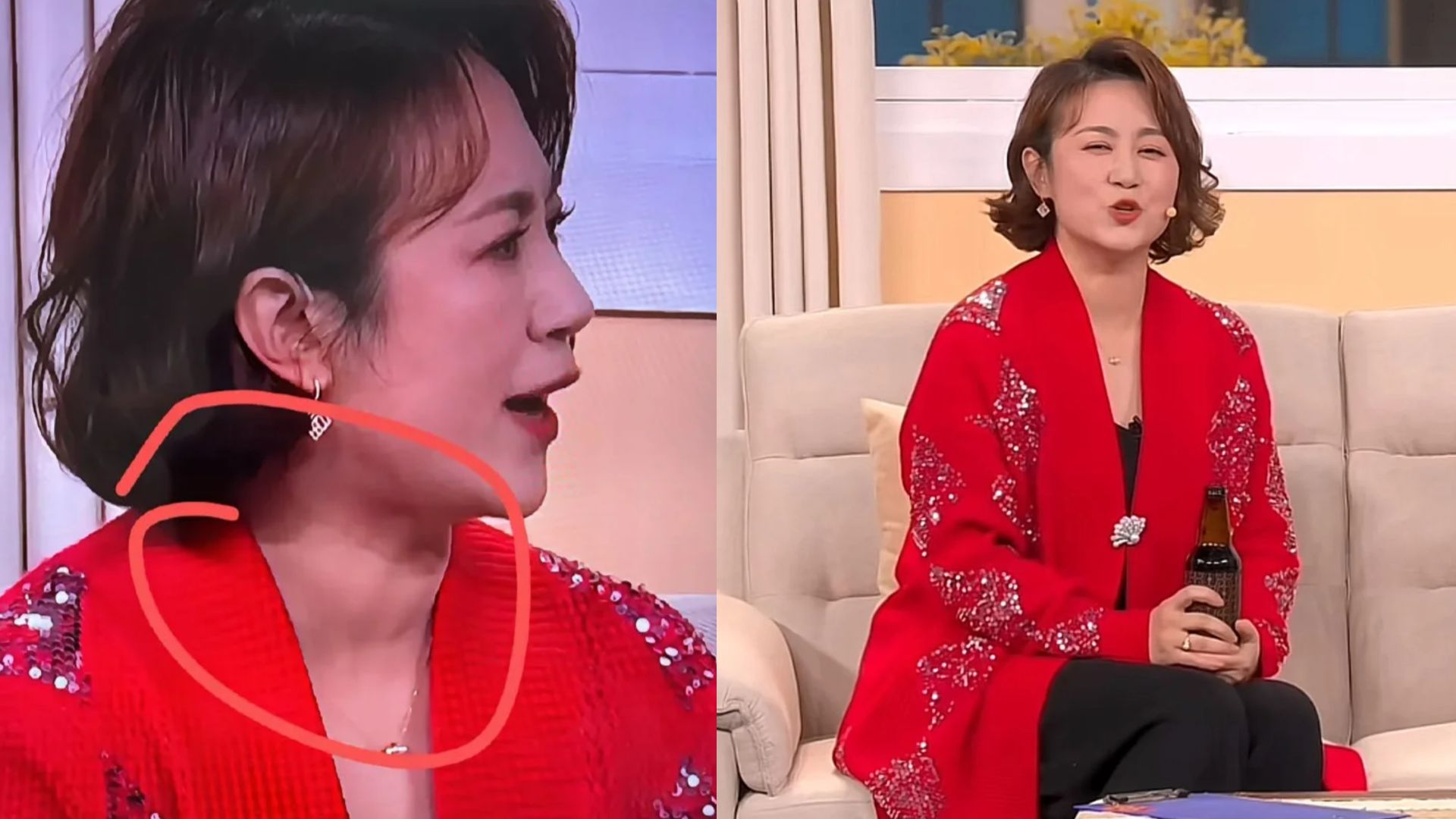 马丽甲状腺疑似肿大？网友纷纷喊话本人快查查！马丽回应