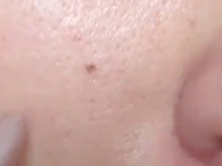 美白误区警示皮肤屏障修复