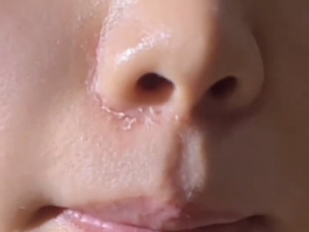 换季护肤秘籍水润焕白之道