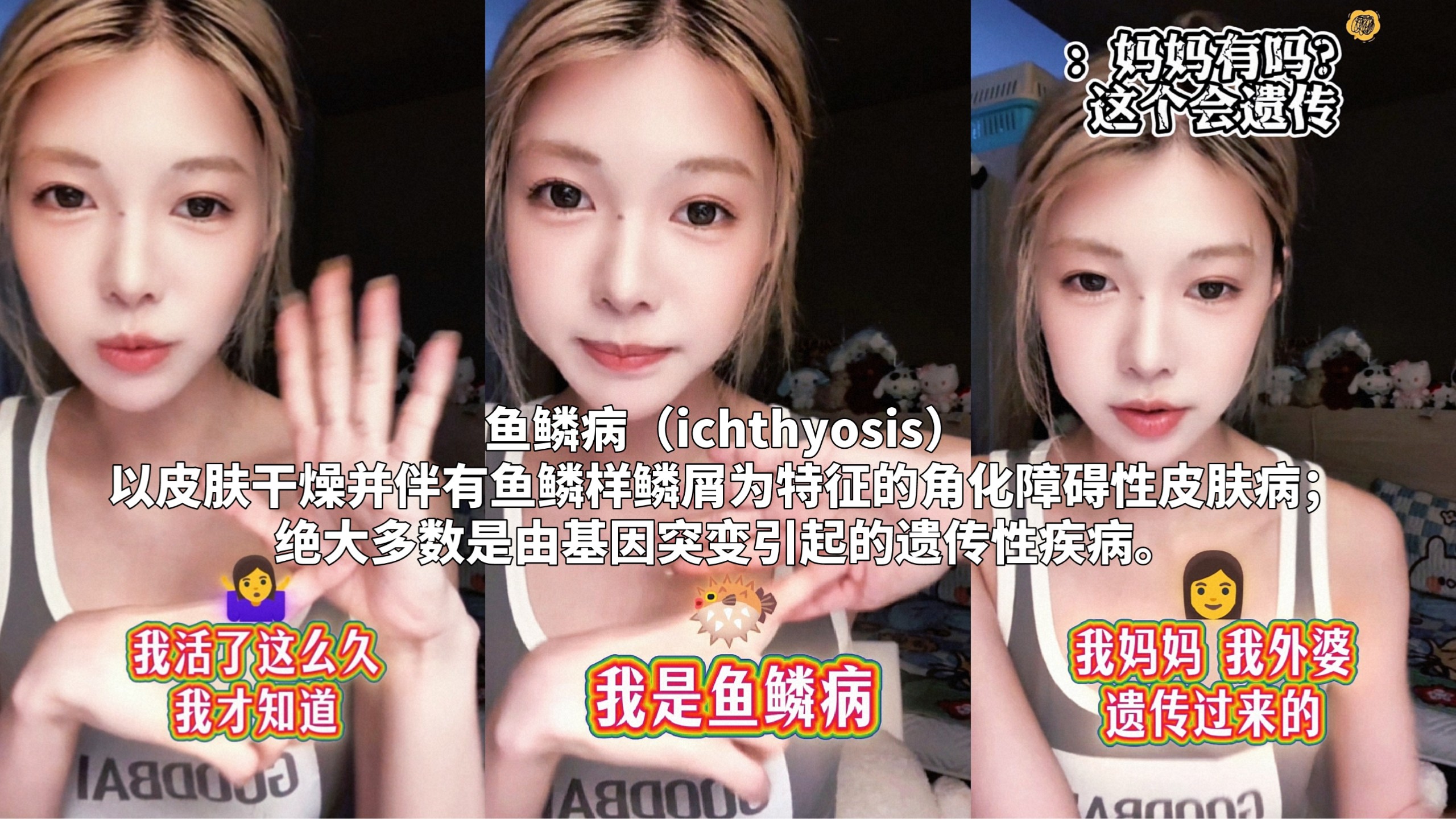【张琼予】活到现在才发现自己被遗传了鱼鳞病……