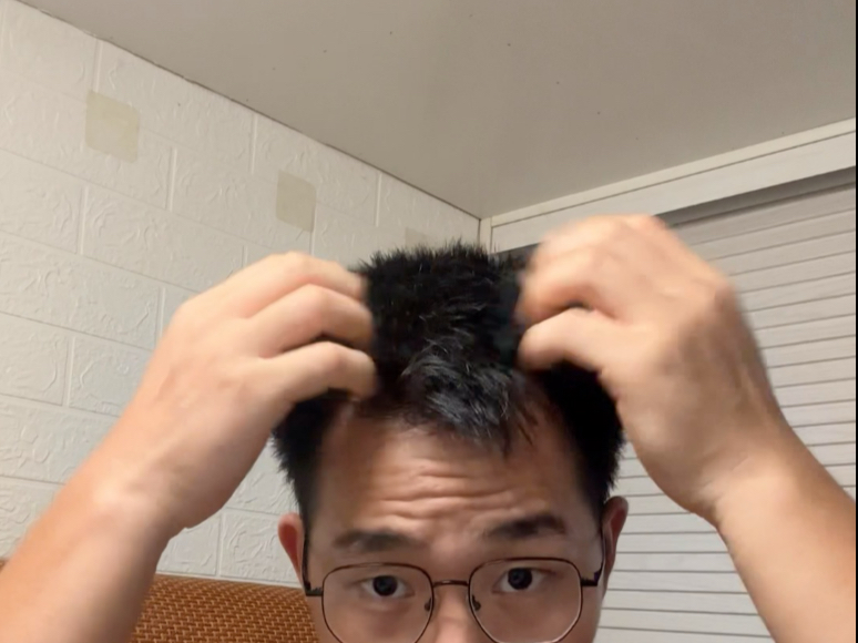 沉浸式拯救发际线