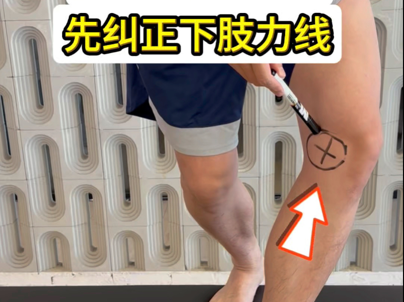 膝盖内侧不得劲先纠正下肢力线 膝盖内侧不得劲先纠正下肢力线
