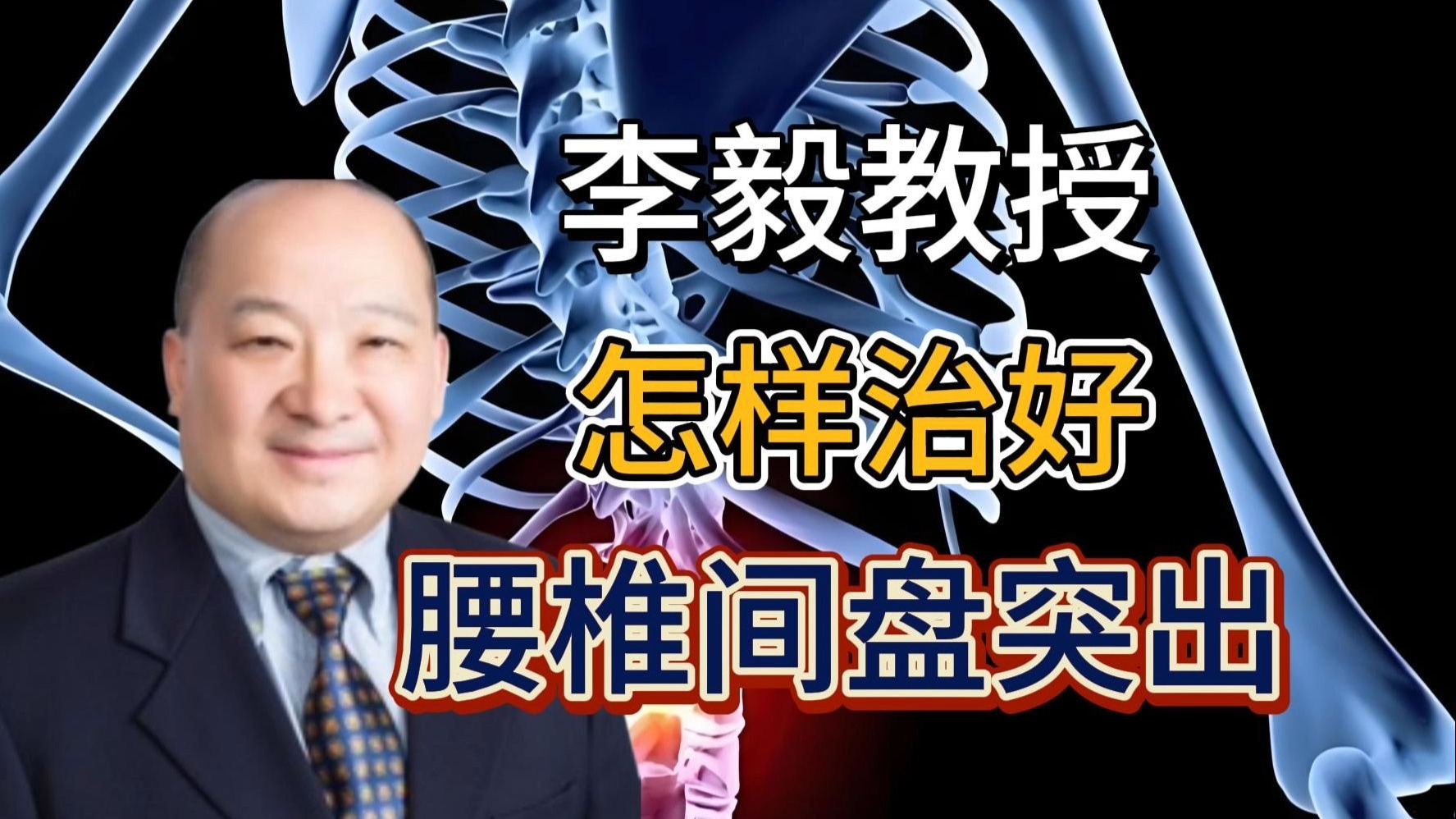 李毅教授怎样治好腰椎间盘突出